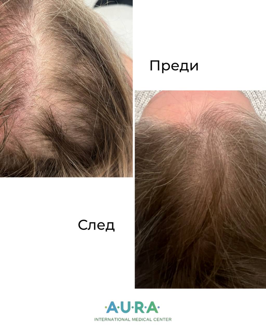Female patient, 67 years old