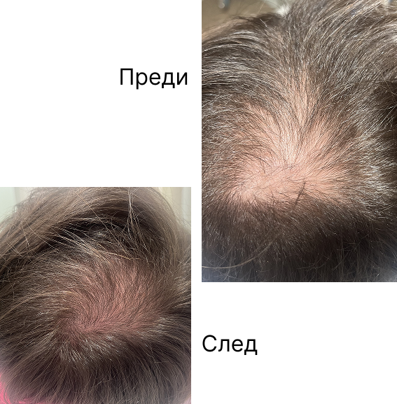 Male patient, 29 years old